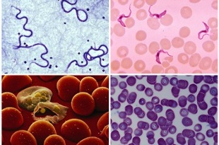 insan kanında hangi parazitler olabilir